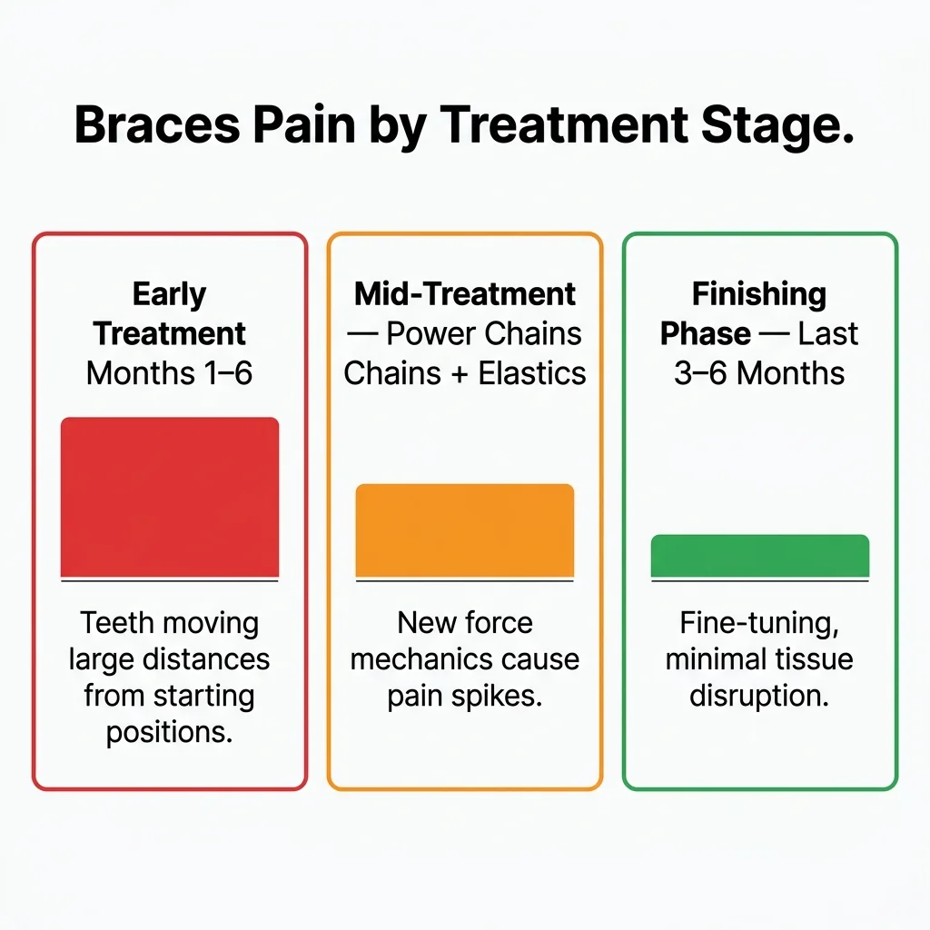 Three-stage comparison: early treatment high pain, mid-treatment power chain spike, finishing phase low pain