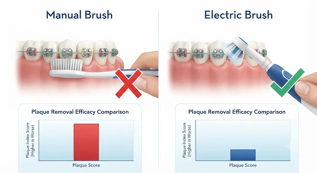 Electric vs manual toothbrush comparison for braces — plaque removal scores and bracket margin cleaning