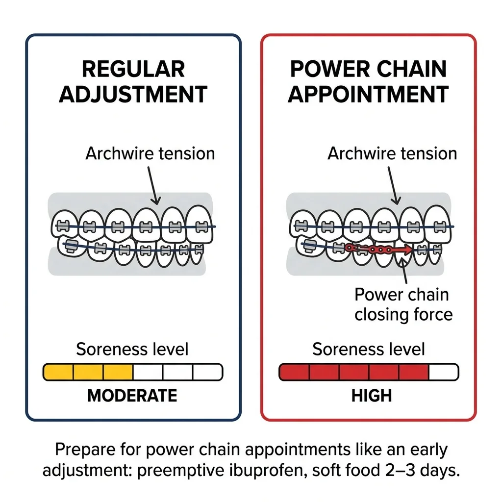 Comparison of regular adjustment moderate soreness versus power chain appointment high soreness