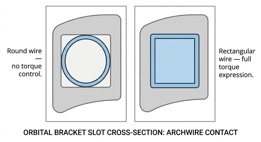 Diagram comparing round wire (no torque control) vs rectangular wire filling bracket slot (full torque control)